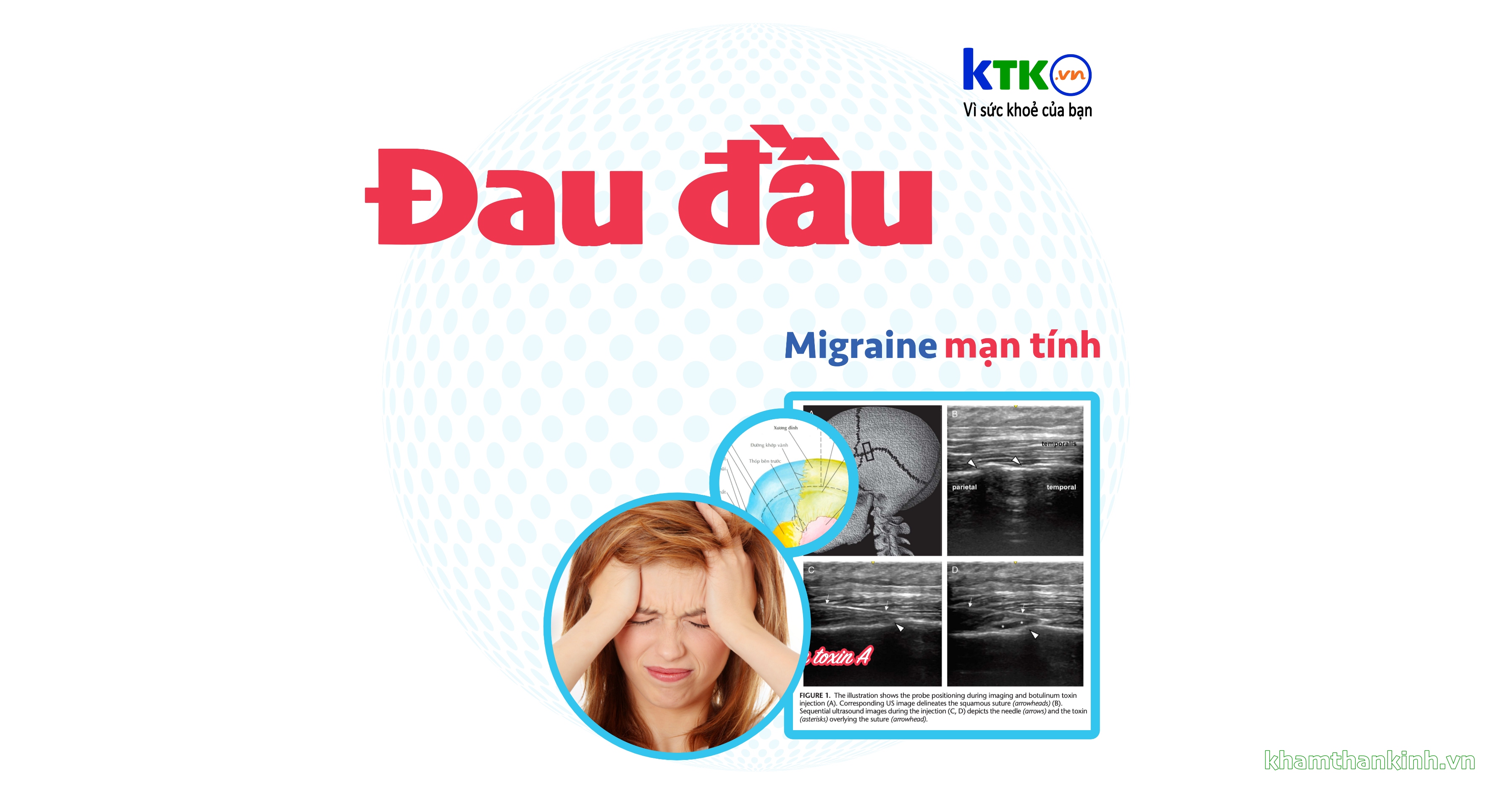 Đau đầu - Phân loại mới theo Hiệp hội đau đầu Quốc tế.